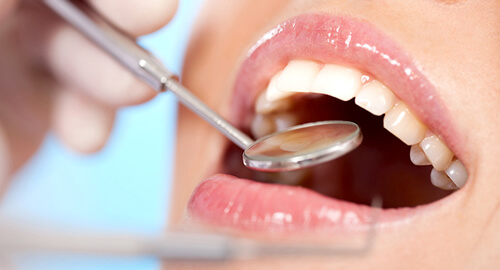 歯を守る定期検診